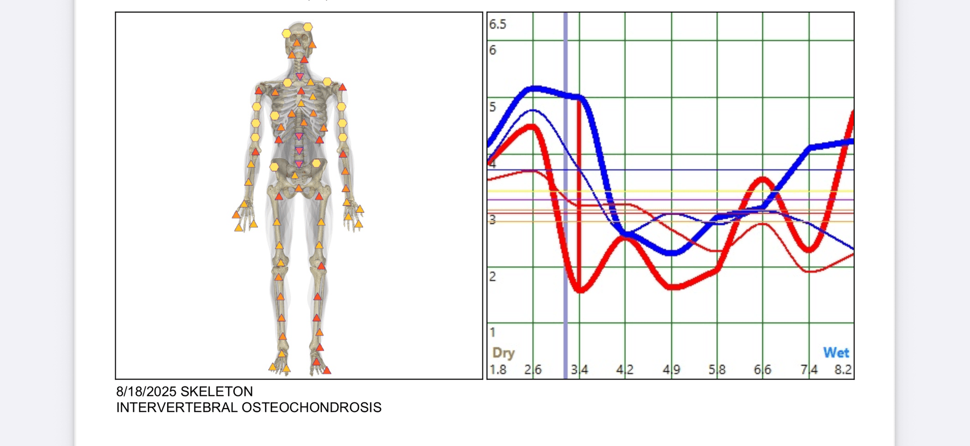 Metatron Blue Opal Analysis